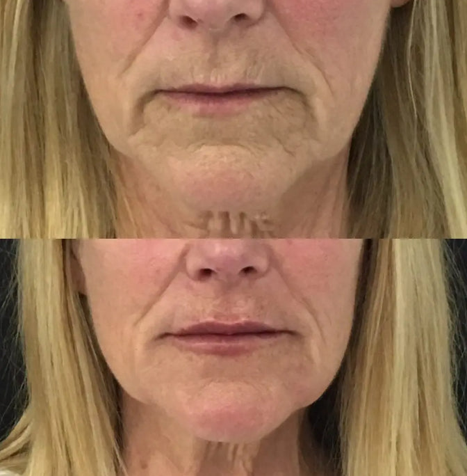 finones™ - Skin Vitamin Serum