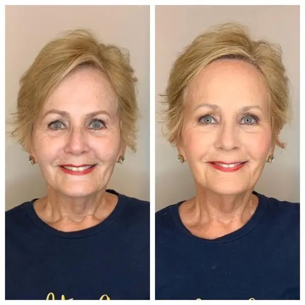 finones™ - Skin Vitamin Serum