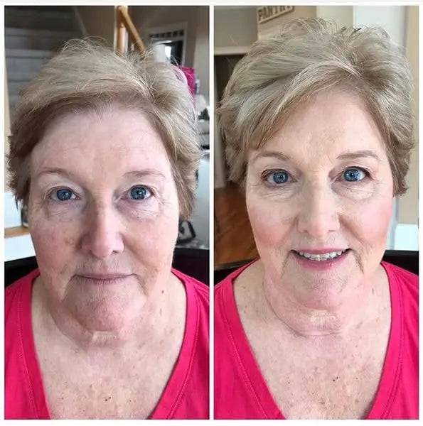 finones™ - Skin Vitamin Serum
